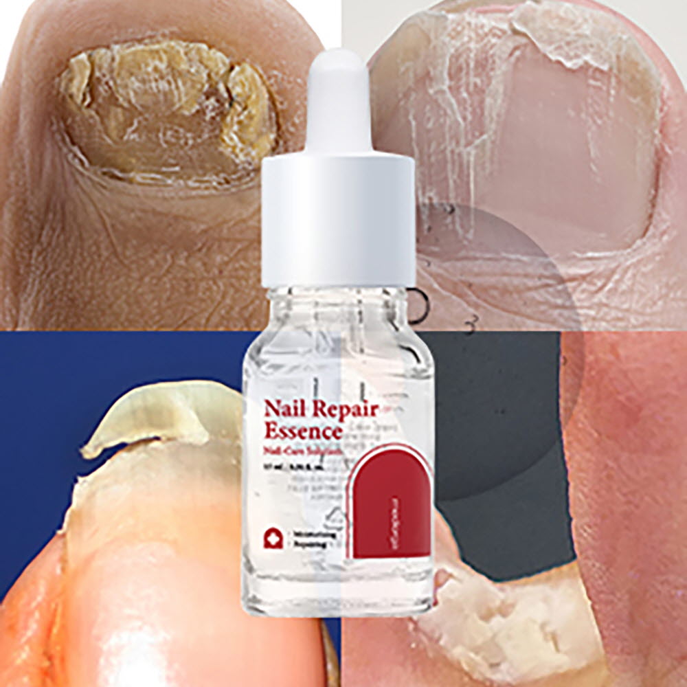 1651653284 thumbnail